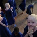 Albinos in Africa endangered by election