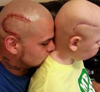 Father takes tattoo scar son