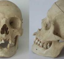 Man finds skull in garden: appears to be of his predecessor