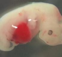 Scientists create embryonic human and porcine