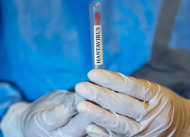 WHO Raises Alarm as Hantavirus Cases Increase